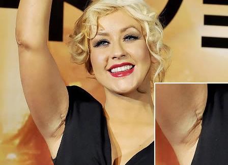 Cât de urâte sunt! Topul celor mai nereuşite operaţii estetice 103578