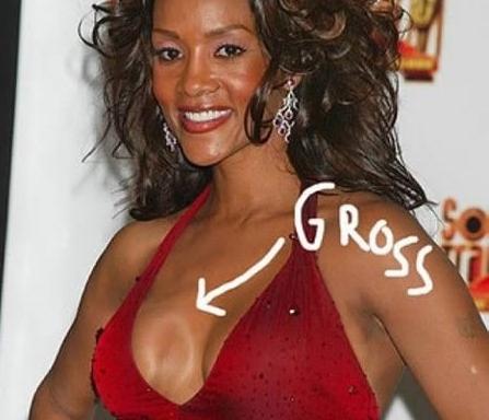 Cât de urâte sunt! Topul celor mai nereuşite operaţii estetice 103580