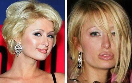 Cât de urâte sunt! Topul celor mai nereuşite operaţii estetice 103582