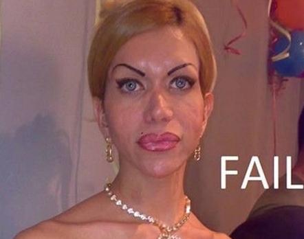 Cât de urâte sunt! Topul celor mai nereuşite operaţii estetice 103583