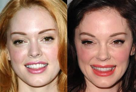 Cât de urâte sunt! Topul celor mai nereuşite operaţii estetice 103585