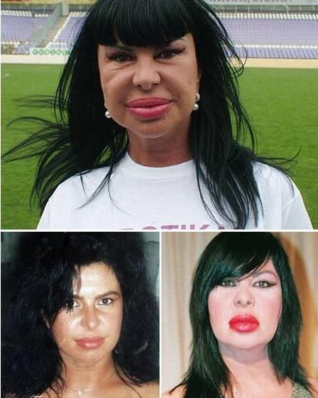 Cât de urâte sunt! Topul celor mai nereuşite operaţii estetice 103586