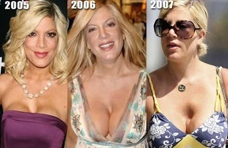 Cât de urâte sunt! Topul celor mai nereuşite operaţii estetice 103587