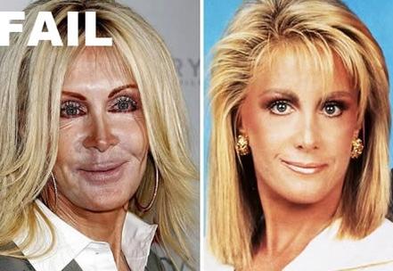 Cât de urâte sunt! Topul celor mai nereuşite operaţii estetice 103589