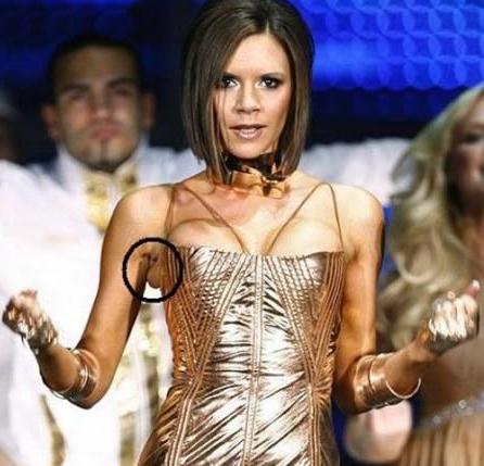 Cât de urâte sunt! Topul celor mai nereuşite operaţii estetice 103590