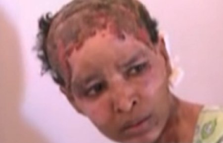 Imagini şocante: Bona copiilor lui Hannibal Gaddafi, mutilată de soţia acestuia