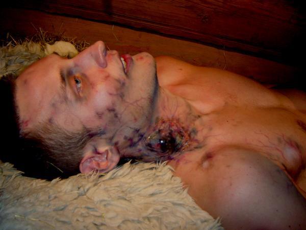 Contagiunea: când viruşii scapă de sub control. Vezi un top cu cele mai grave maladii din lume 109841