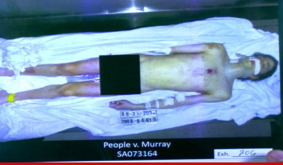Foto ŞOCANTE! Trupul lui Michael Jackson, dezbrăcat pe masa de autopsie