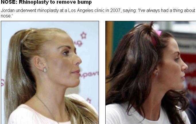 Femeia care e 90% &quot;fake&quot;. &quot;Operaţiile estetice m-au ruinat&quot;. Vezi cum arată 112314