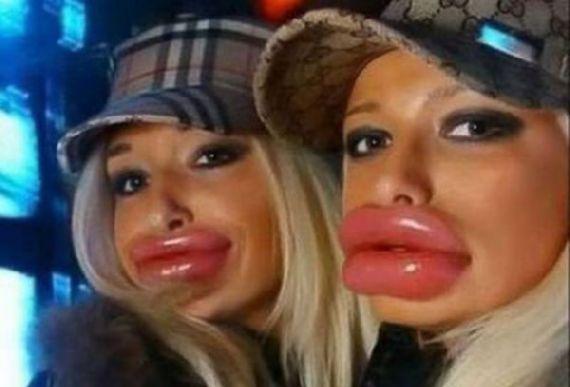 Piţipoanca e &quot;emblemă&quot;, vrea botox-ul sus pe stemă! Vezi o galerie foto cu cele mai penibile transformări 112228