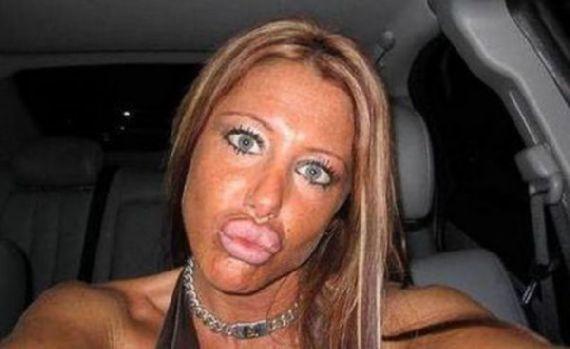 Piţipoanca e &quot;emblemă&quot;, vrea botox-ul sus pe stemă! Vezi o galerie foto cu cele mai penibile transformări 112233