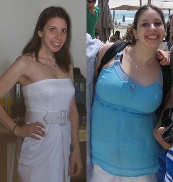 Obiceiul pe care îl ai şi tu le-a făcut monştri. Vezi o transformare incredibilă 113627