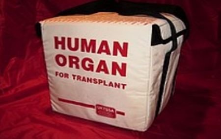 Un israelian a recunoscut că a făcut trafic cu organe prelevate de la români
