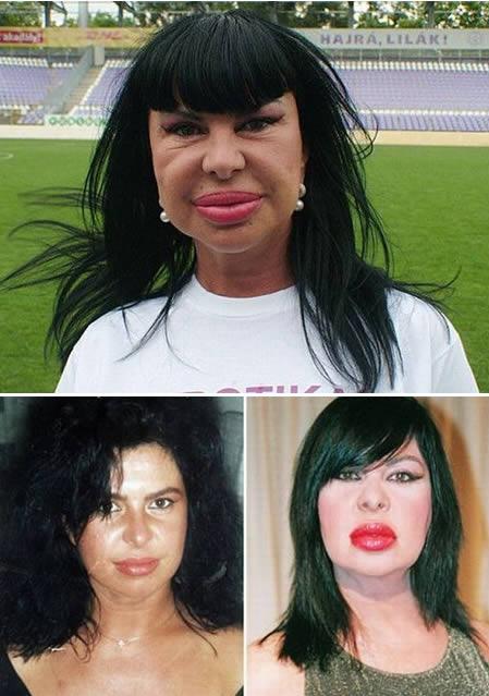 Când în loc de creier, e Botox. Miss Piggy e mic copil pe lângă ea. Vezi top dezastre siliconate 113704