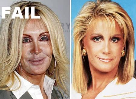 Când în loc de creier, e Botox. Miss Piggy e mic copil pe lângă ea. Vezi top dezastre siliconate 113706