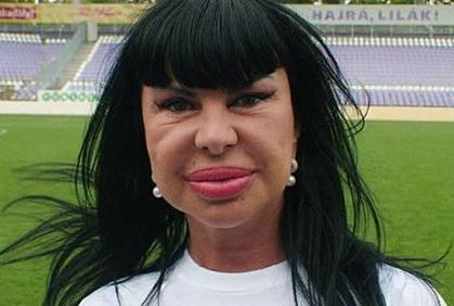 Când în loc de creier, e Botox. Miss Piggy e mic copil pe lângă ea. Vezi top dezastre siliconate 113707