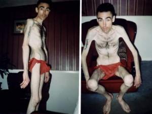 Cum a ajuns să arate aşa? Boala de care poţi suferi şi tu fără să ştii! 116529