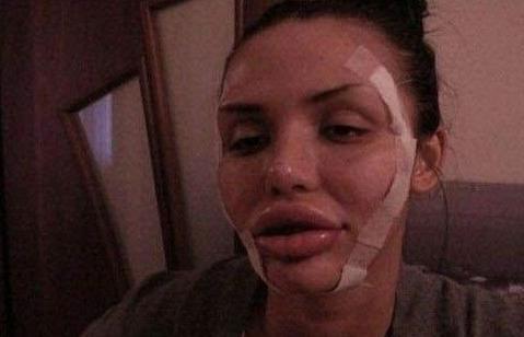 Transformarea şocantă din procesul "plastifierea piţipoancei". N-o să îţi vină să crezi că e aceeaşi persoană 116544