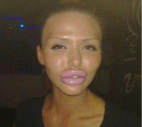 Transformarea şocantă din procesul "plastifierea piţipoancei". N-o să îţi vină să crezi că e aceeaşi persoană 116545