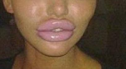 Transformarea şocantă din procesul "plastifierea piţipoancei". N-o să îţi vină să crezi că e aceeaşi persoană 116546