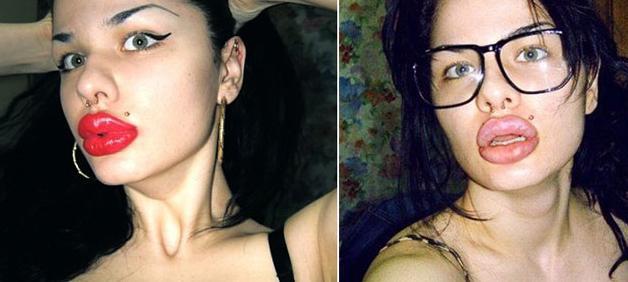 Botoxată şi rujată, parcă a-nghiţit o roată! Transformarea unei fete normale într-o piţi autentică 117972