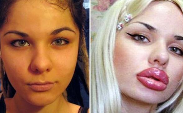 Botoxată şi rujată, parcă a-nghiţit o roată! Transformarea unei fete normale într-o piţi autentică 117973