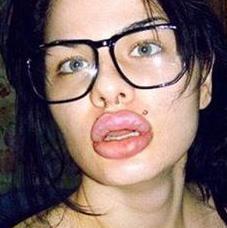 Botoxată şi rujată, parcă a-nghiţit o roată! Transformarea unei fete normale într-o piţi autentică 117978