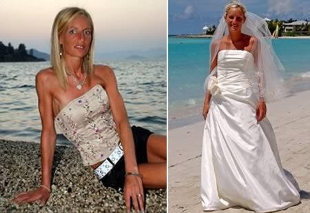 Cel mai sexy bărbat a murit din cauza anorexiei. Cazuri şocante, care au cutremurat lumea 119141