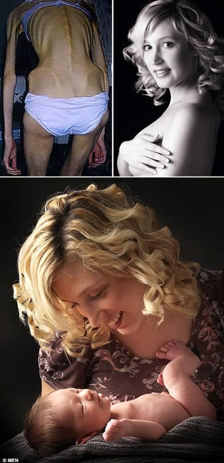 Cel mai sexy bărbat a murit din cauza anorexiei. Cazuri şocante, care au cutremurat lumea 119142