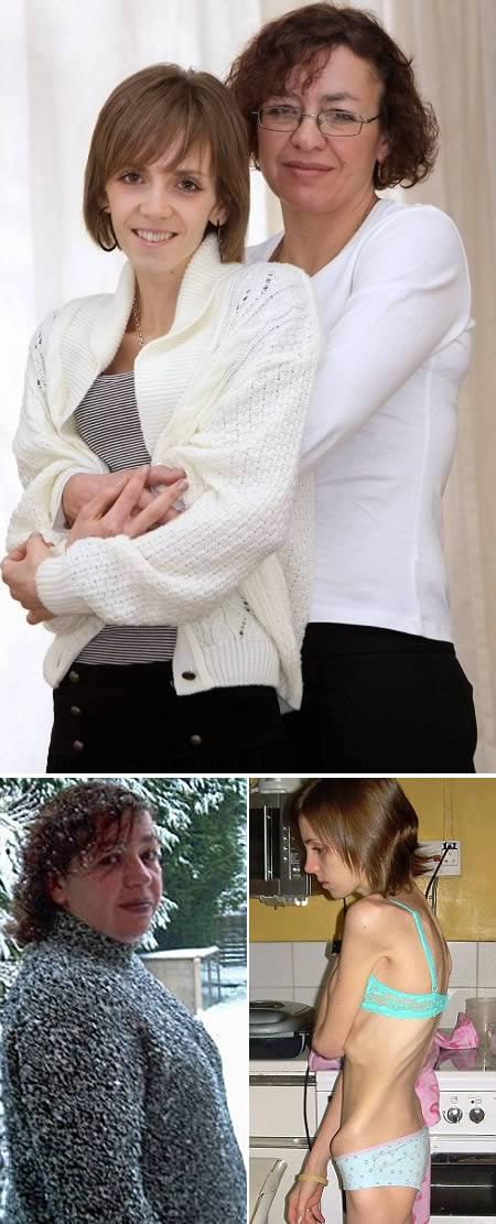 Cel mai sexy bărbat a murit din cauza anorexiei. Cazuri şocante, care au cutremurat lumea 119145