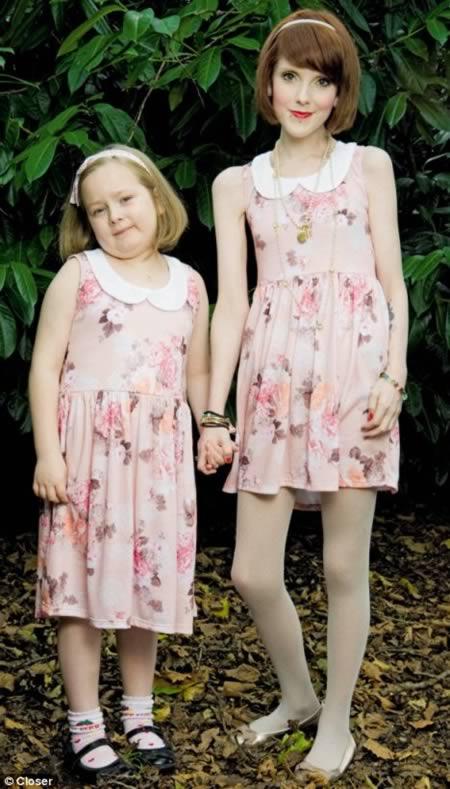 Cel mai sexy bărbat a murit din cauza anorexiei. Cazuri şocante, care au cutremurat lumea 119147