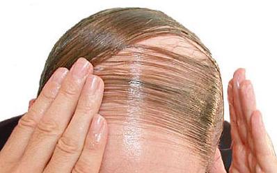 ŞOCANT! Vezi ce super model a ajuns să arate aşa! Blestemul celebrităţii i-a distrus frumuseţea 119101