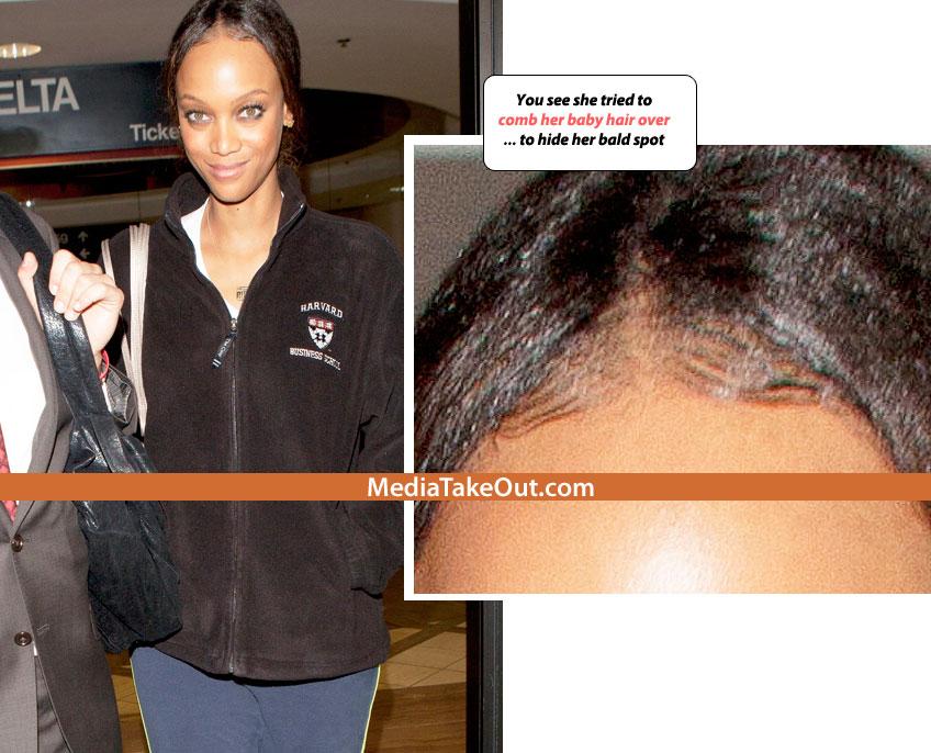 ŞOCANT! Vezi ce super model a ajuns să arate aşa! Blestemul celebrităţii i-a distrus frumuseţea 119103