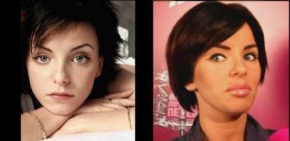 Şi pe tine te-a incitat când ai văzut-o. Acum a ajuns o &quot;epavă botoxată&quot;. Nu o vei mai recunoaşte 120301