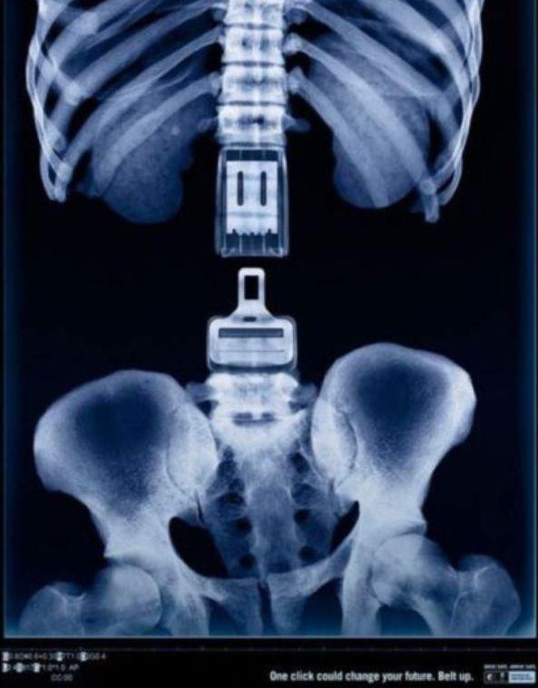 Ai curaj să te uiţi la ele? Topul celor mai SCÂRBOASE reclame  124246