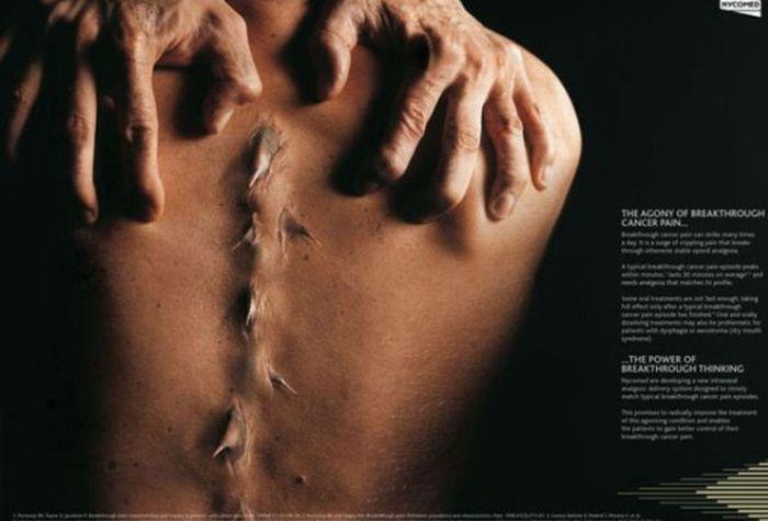 Ai curaj să te uiţi la ele? Topul celor mai SCÂRBOASE reclame  124250