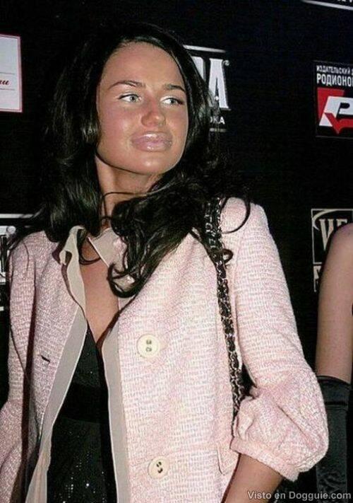 Când e prea mult nici lui Dumnezeu nu-i place. Pentru ele siliconul ar trebui interzis 125776