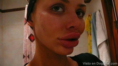 Când e prea mult nici lui Dumnezeu nu-i place. Pentru ele siliconul ar trebui interzis 125777