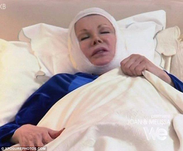 S-a speriat când şi-a văzut chipul în oglindă! Vezi ce actriţă a fost măcelărită de chirurgul estetician 127895