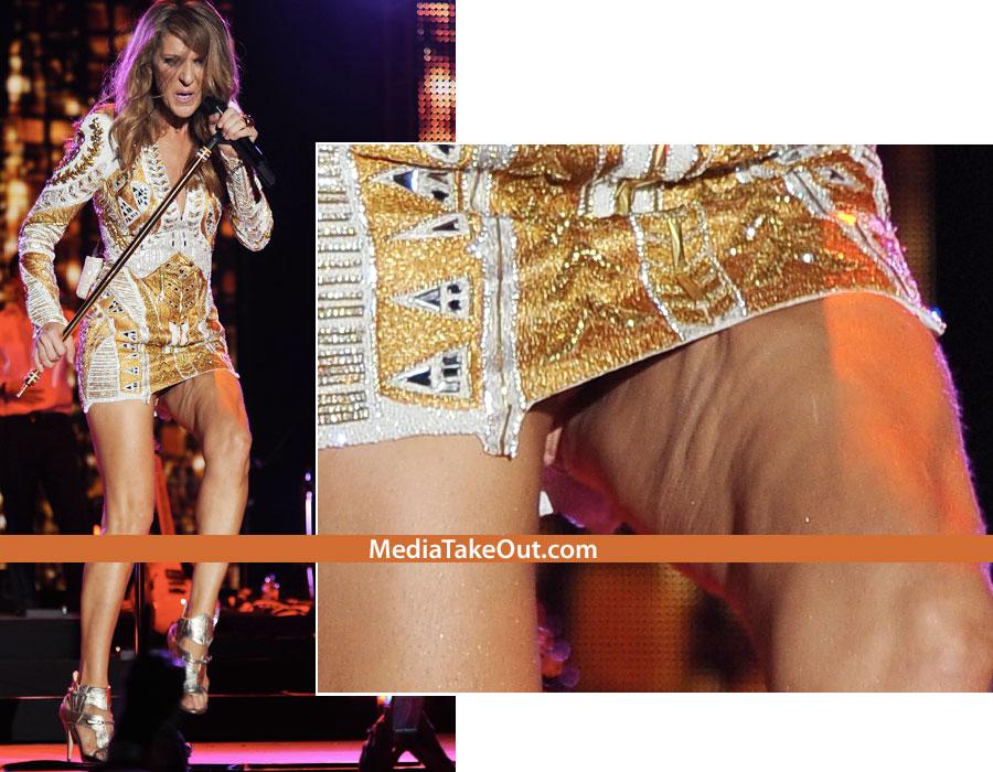 Picioarele divei, valurile mării! Motivul clar pentru care NU ar mai trebui să poarte fuste scurte 128787