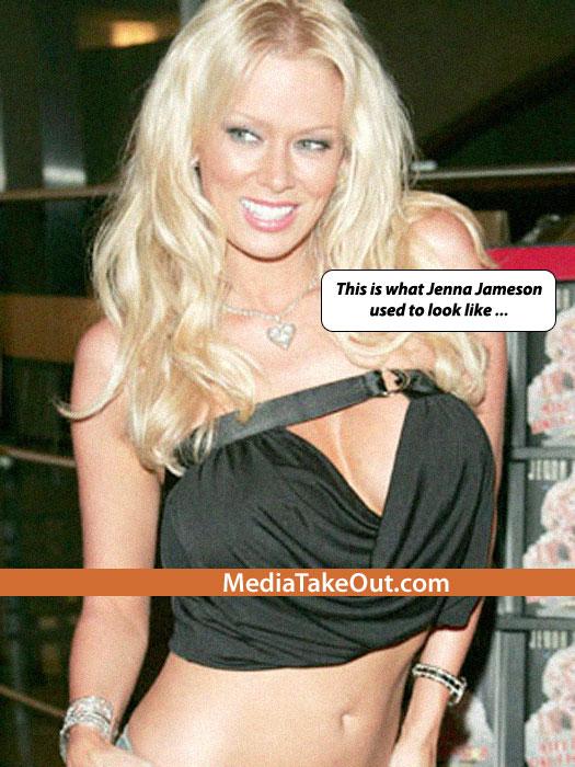 I-a îngheţat faţa! Cea mai faimoasă actriţă XXX, distrusă de operaţiile estetice. O mai recunoşti? 129649