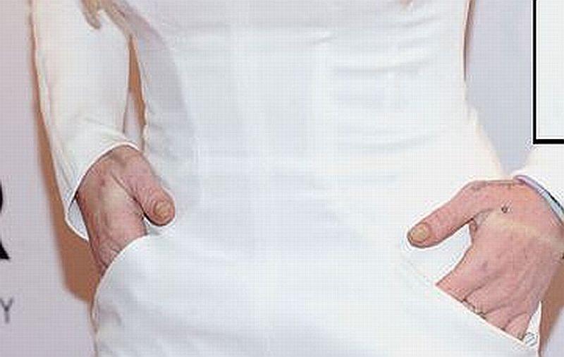 Mâinile care ascund PRĂBUŞIREA unei vedete. &quot;E la un pas de moarte dacă nu se opreşte&quot; 130469