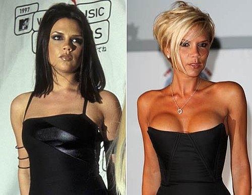 Victoria Beckham: imaginea care i-a şocat pe doctorii plasticieni 131809