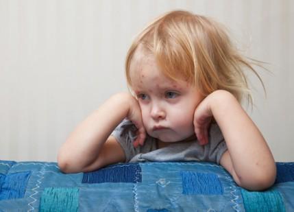 Trei focare de varicelă, confirmate în mai multe grădiniţe din Vaslui şi Bârlad: 40 de copii bolnavi