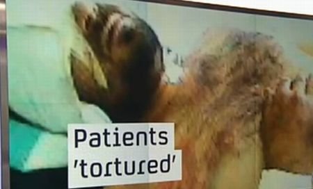 IMAGINI ŞOCANTE. Ororile din spitalele siriene. Pacienţii sunt torturaţi de doctorii care ar trebui să-i îngrijească