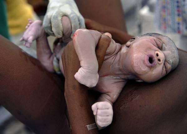 Oameni pentru care fericirea este adusă de moarte. Cele mai impresionante fotografii premiate cu Pulitzer 135885