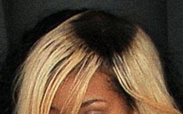 Imaginea care prevesteşte colapsul. Cea mai iubită vedetă, într-o stare deplorabilă 136322