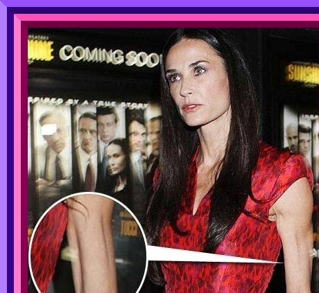 Luna trecută lumea credea că o să moară. Vedeta vindecată miraculos de Photoshop vs. crunta realitate 137126