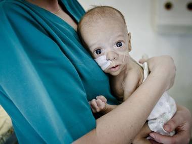 Radiografia dură, care poate ne va trezi la realitate. The Independent: Bebeluşii români, lăsaţi să moară dacă medicii nu primesc şpagă