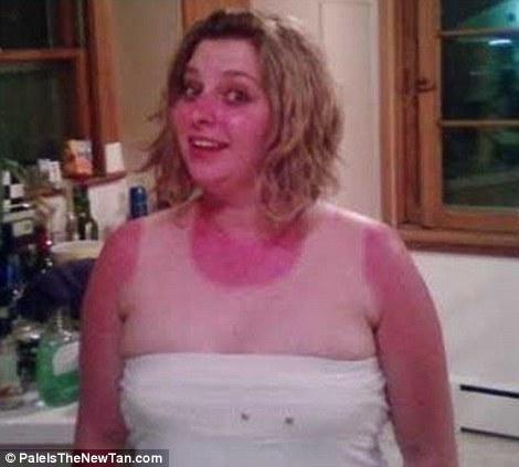 S-au stafidit de când tot stau la plajă. Şi-au bătut singuri joc de trupul lor. Exemple umane de &quot;aşa NU&quot; 141200